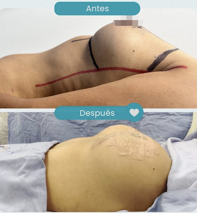 Resultados levantamiento de senos